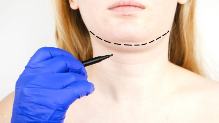 4 maneiras de evitar a famosa “papada” e ter um pescoço invejável